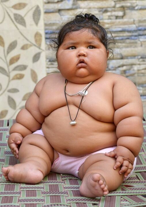 Being overweight causes osteoarthritis