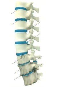 how osteochondrosis of the lumbar spine manifests itself