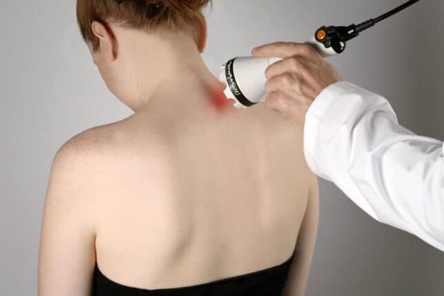 Laser therapy is used to combat back pain in the shoulder blade area. 