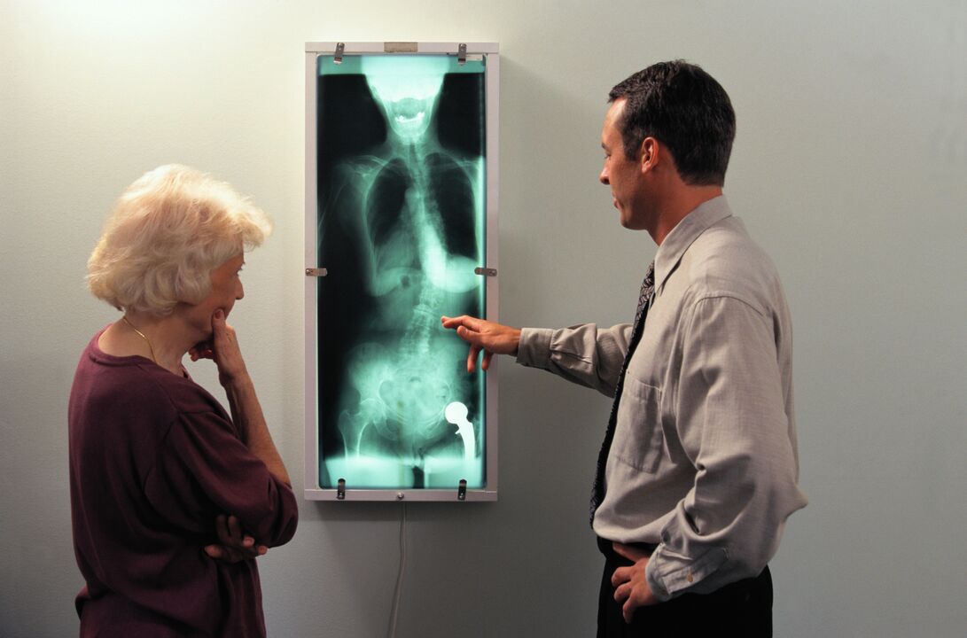 x-ray diagnosis of hip pain